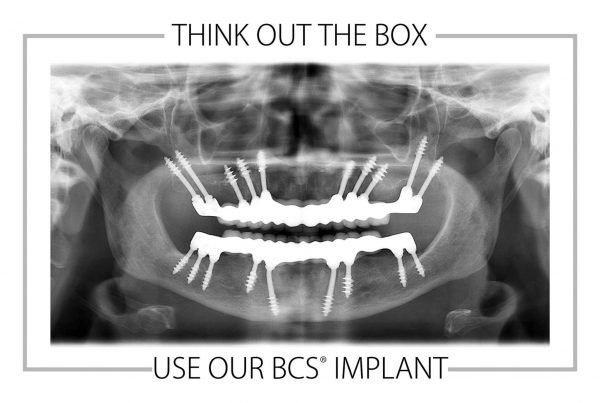 implantología estratégica hueso cortical radiografía ortopanorámica implantes multidireccionales